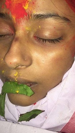 Công bố ảnh Pratyusha Banerjee xuất hiện nhiều vết bầm tím khi qua đời