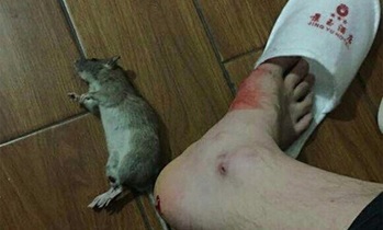 Bị chuột cắn: Hãy cẩn thận kẻo mắc bệnh Sodoku