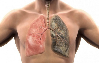 Những dấu hiệu cảnh báo bệnh phổi đang phát triển âm thầm trong cơ thể