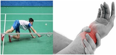 Tại sao cổ tay thường bị đau khi chơi tennis