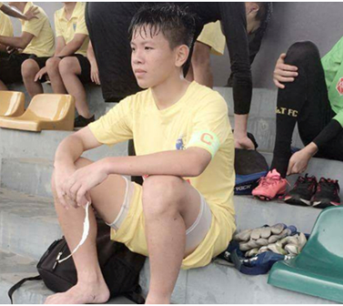 Cầu thủ U15 Thanh Hóa bị dọa cắt gân chân thực hư thế nào?