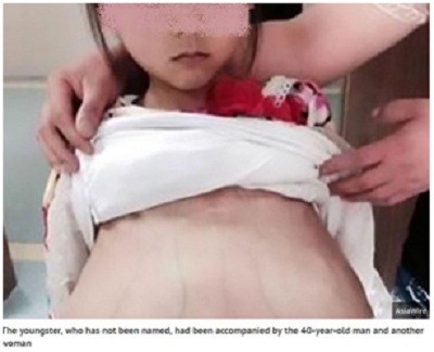 Xác minh bé 12 tuổi mang thai ở Trung Quốc là người Việt Nam