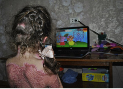 Báo động: Trò chơi trực tuyến Nàng tiên lửa biến bé 5 tuổi thành ngọn đuốc