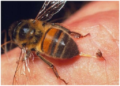 Bạn đã biết cách xử lý cơ bản khi bị ong đốt?