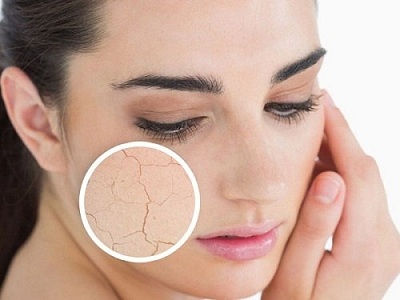 Cấu tạo lớp da và cách phòng tránh da khô, nứt nẻ