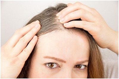 Mách bạn mẹo điều trị tóc bạc sớm cực kỳ hiệu quả