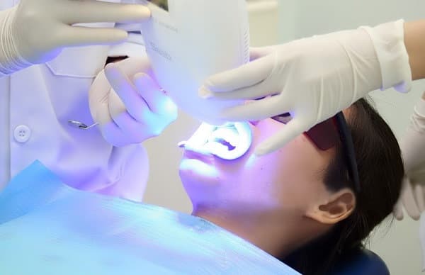 Có nên tẩy trắng răng laser?