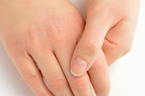 Câu trắc nghiệm Sinh học lớp 8 Bài 41 có đáp án: Cấu tạo và chức năng của da (tiếp)