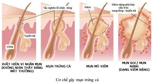 Câu trắc nghiệm Sinh học lớp 8 Bài 42 có đáp án: Vệ sinh da (tiếp)