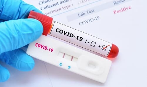 Danh sách các cơ sở y tế được cấp phép xét nghiệm PCR covid-19 theo các tỉnh