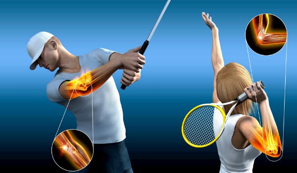 Sai lầm phổ biến gây chấn thương khi chơi tennis